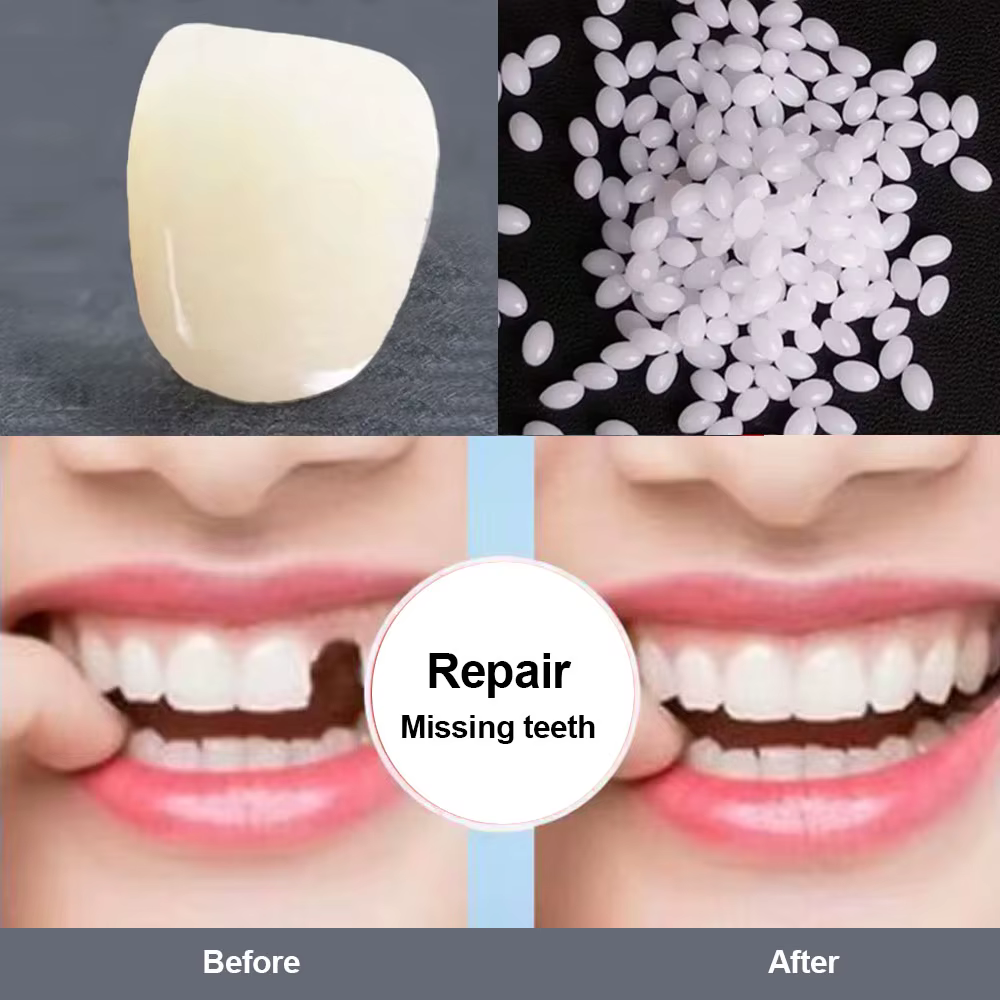 Resin Tooth Permanent High Hardness Repair Glue Shapeable Teeth Gaps Filling Teeth Repair Falseteeth Glue Safety Dental Supplies